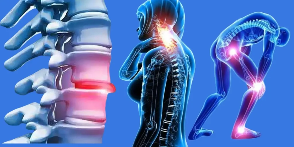 Nerve Pain Breakthrough